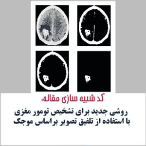 مقاله پیاده سازی شده با متلب : تشخیص تومورهای مغزی با استفاده از موجک